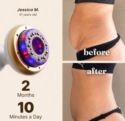 Monaé® CelluGlow™ - Firmer, More Toned Skin