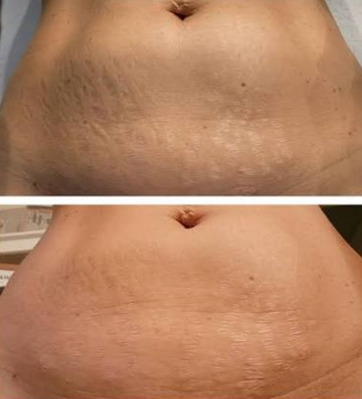 Stephanie R.